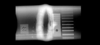 Радиографическое изображение