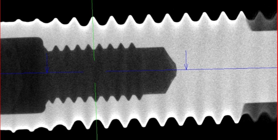 Рентгеновская томография как инструмент исследования дефектов фото 13