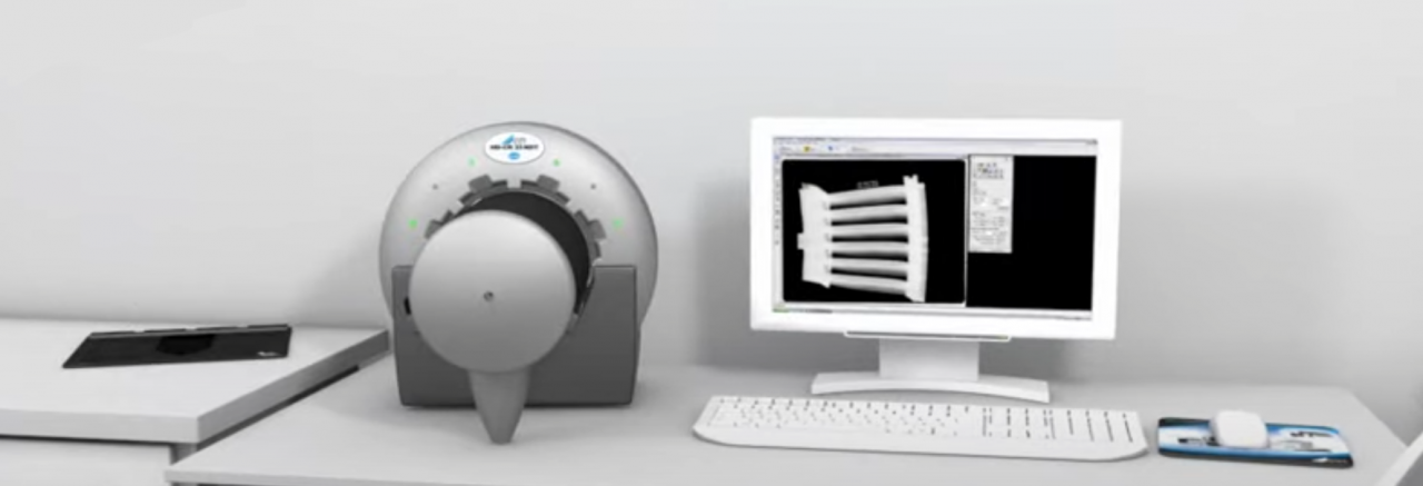 Компьютерная радиография фото 1