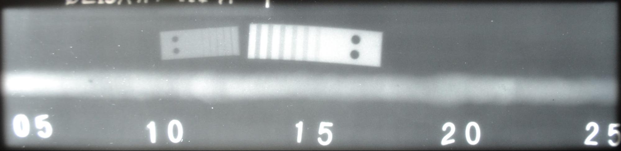 Как выбрать рентгеновский аппарат фото 15