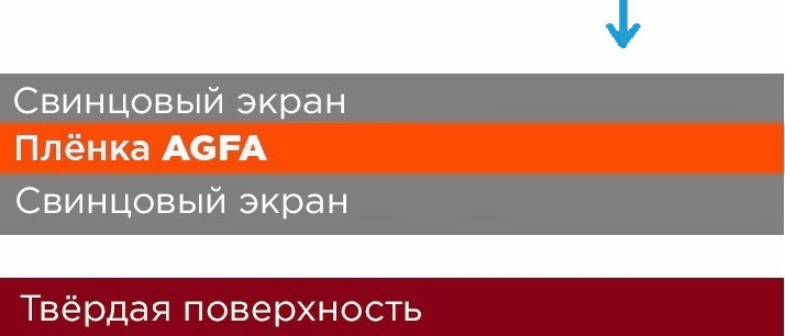 Как выбрать усиливающие экраны фото 2