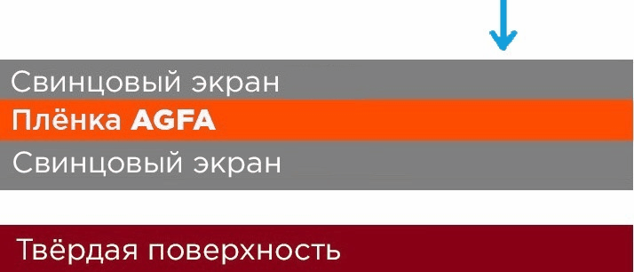 Как выбрать усиливающие экраны фото 4