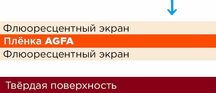 Как выбрать усиливающие экраны фото 7