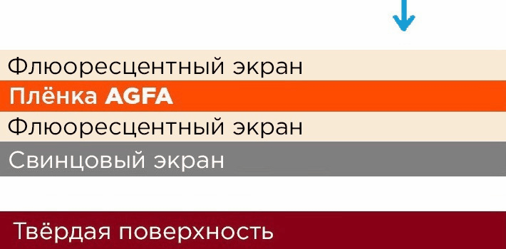 Как выбрать усиливающие экраны фото 8