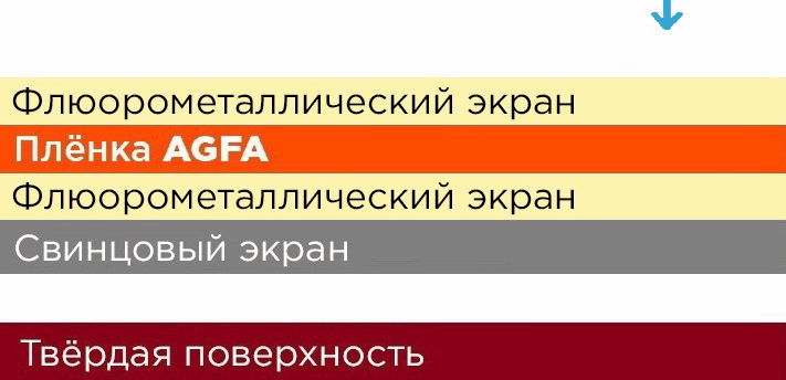 Как выбрать усиливающие экраны фото 12