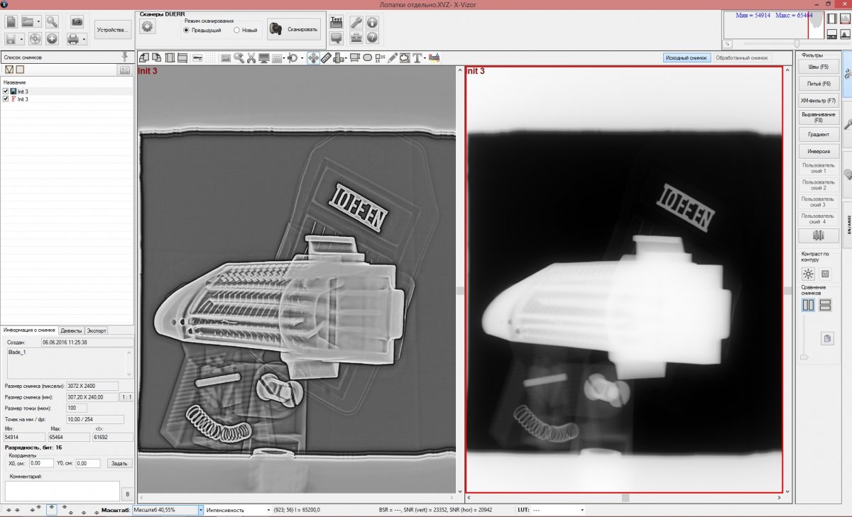 Как выбрать оцифровщик рентгеновских плёнок фото 11